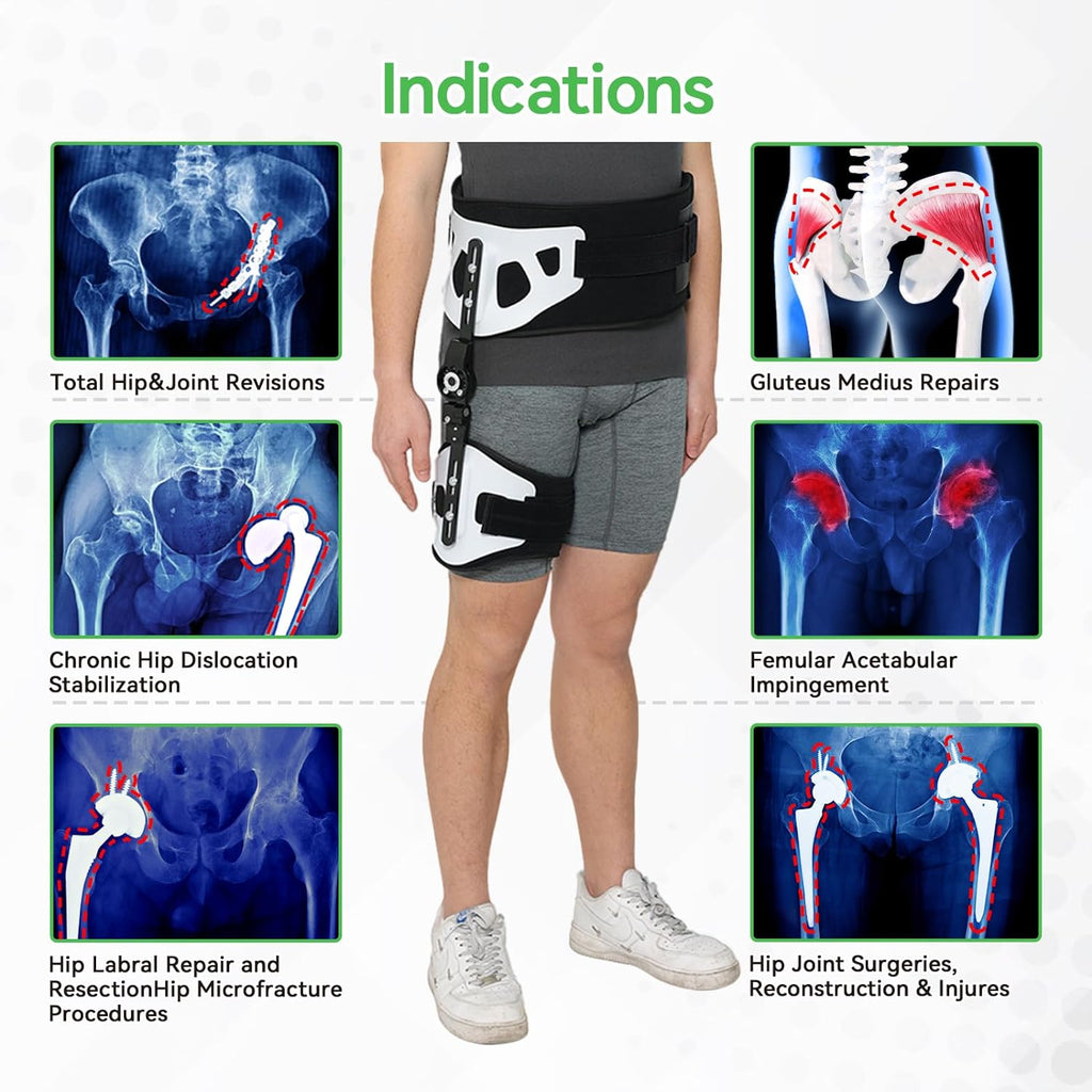 hip abduction brace following hip surgery or dislocation is crucial for  effective recovery – Komzer
